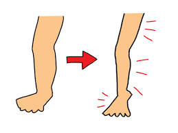 종아리 근육 통증 원인