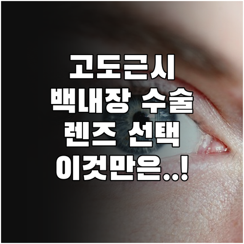 고도근시 백내장 수술 전 확인 사항과..