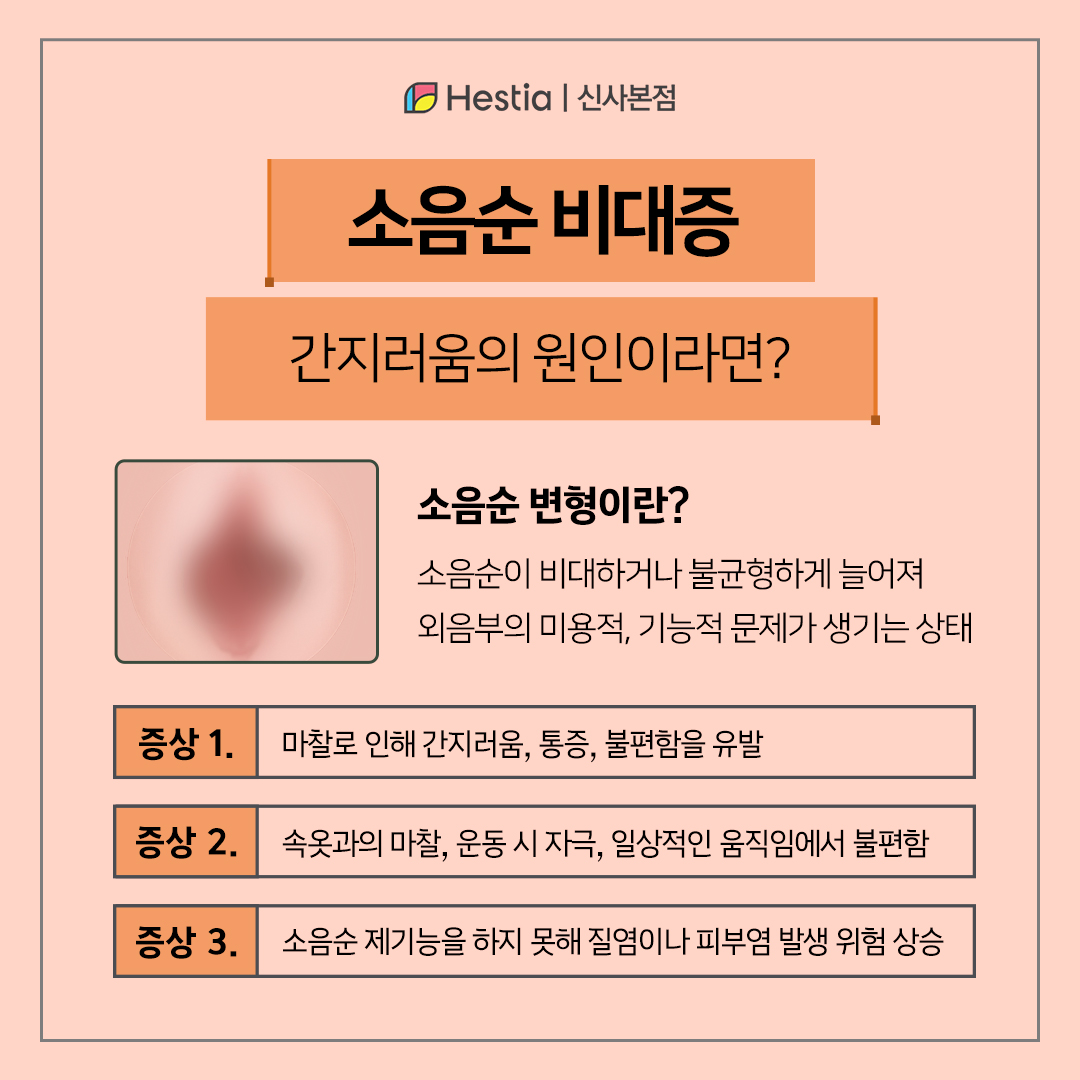 소음순 비대증, 간지러움의 원인이라면?