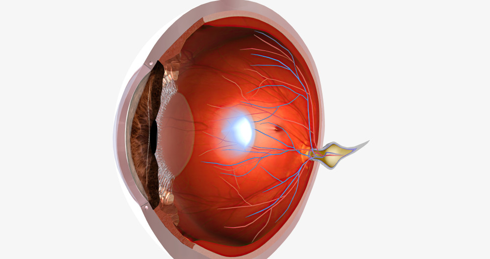 백내장 수술비용