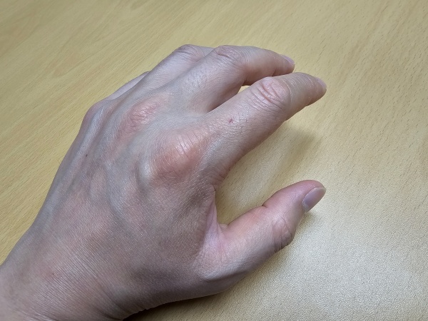 구부러진-손가락