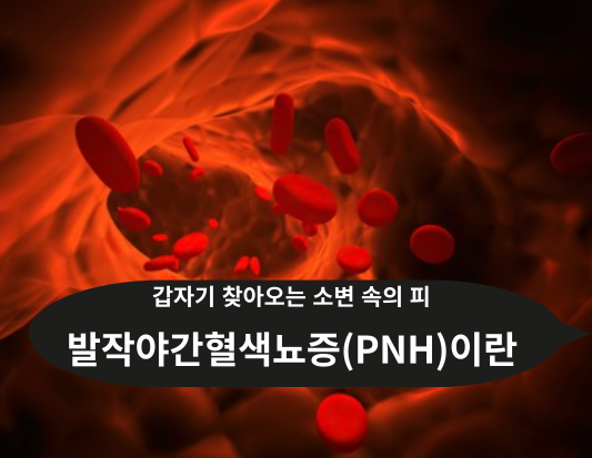 발작야간혈색뇨증 완벽 가이드