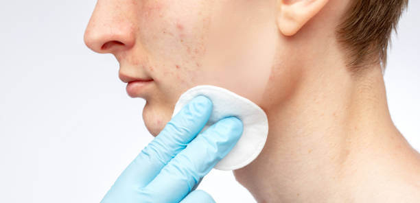 부산 서면·동래 잡티제거 피부과 비교, 가격과 효과는?