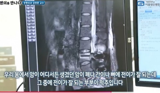 척추명의