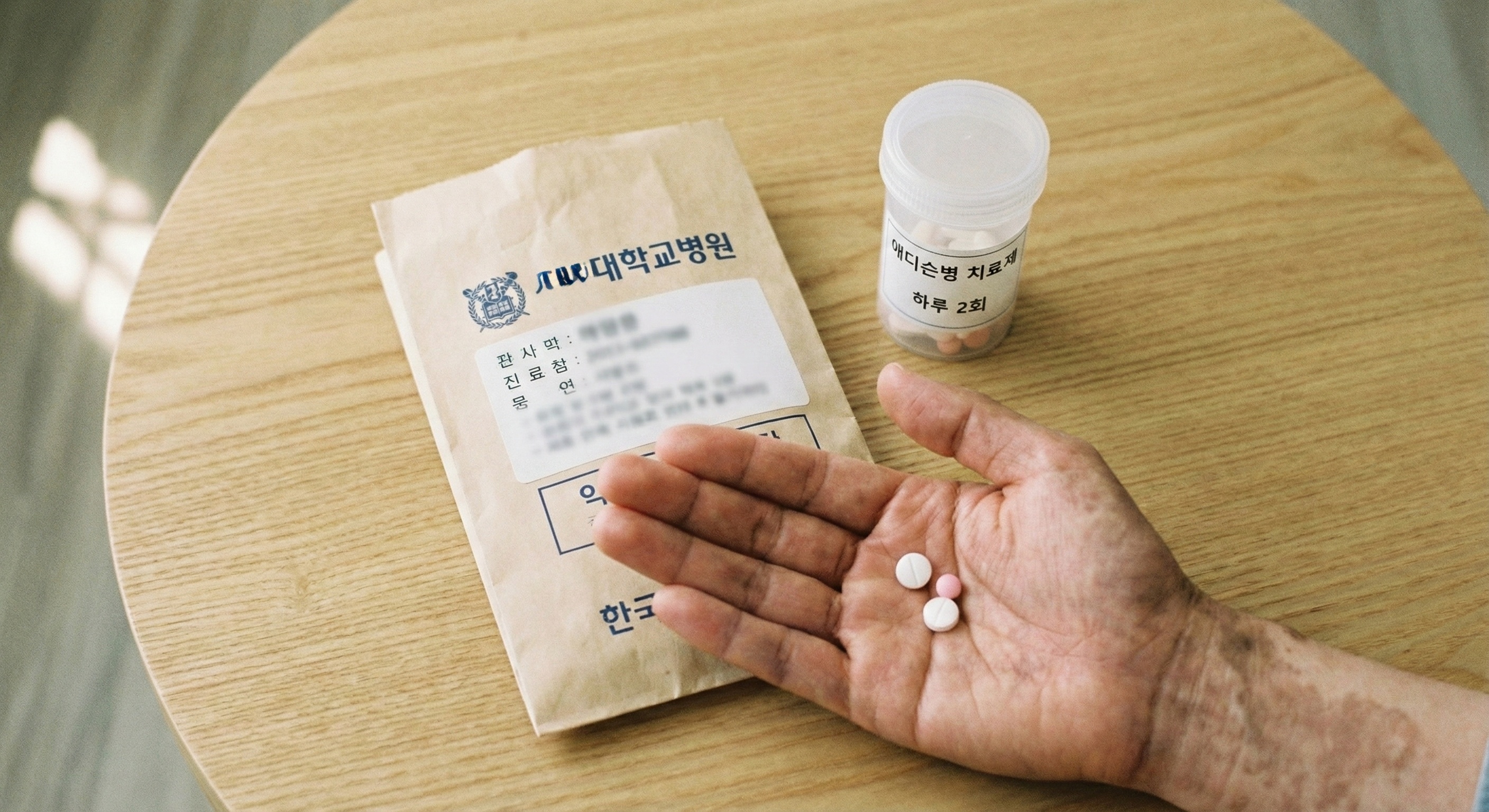 애디슨병 호르몬제