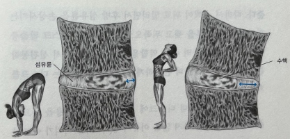 매켄지동작
