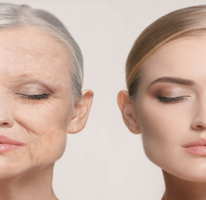 젊은여성과-노인의-피부-비교사진