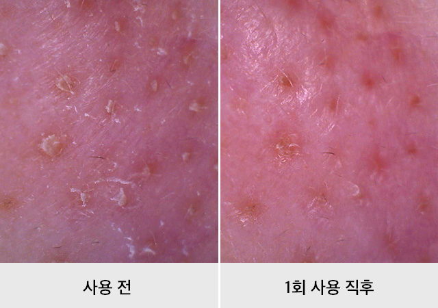 투데이 위드 바디 워시 비포 앤 에프터