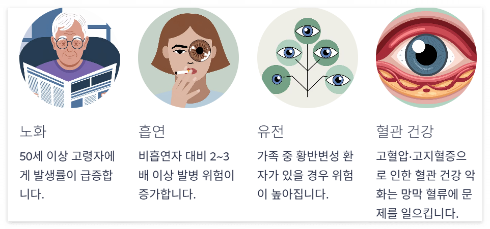 황반변성의 원인과 위험요인