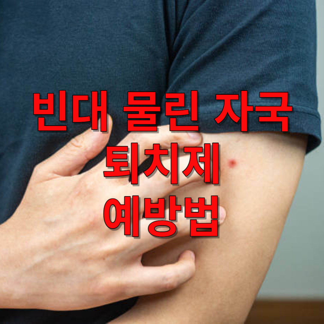 빈대 물린자국, 퇴치제, 예방법