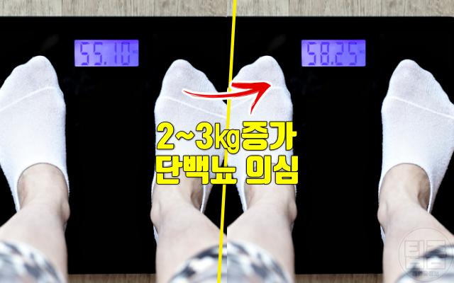 단백뇨 증상 소변거품 체중증가