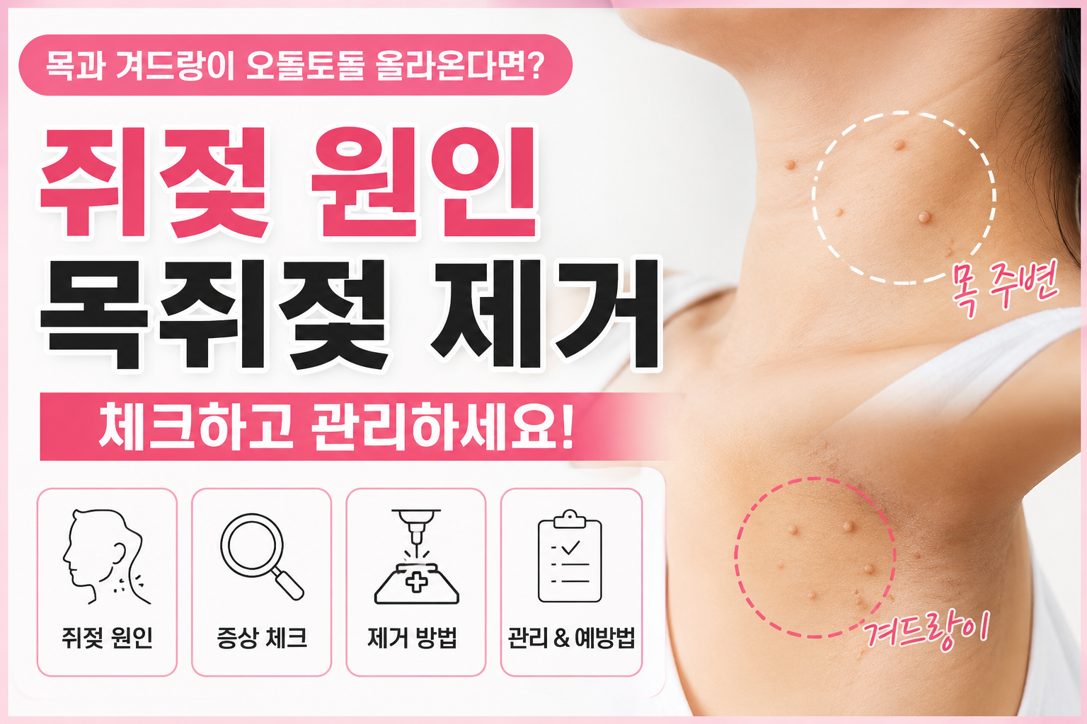 쥐젖원인, 목쥐젖제거 전에 꼭 확인해야 할 것들