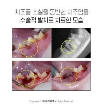 고양이치주염 증상 진단 치료 및 예방법_5