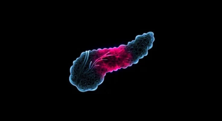 췌장의 역할 췌장암 검사 췌장암 검사종류 췌장암 검사방법