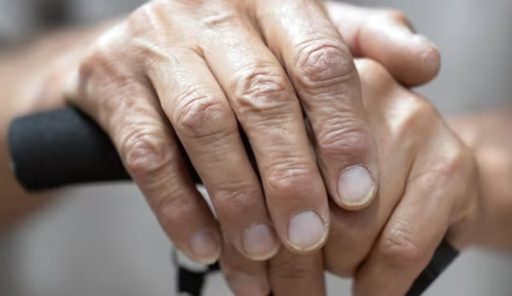 파킨스병의 유전적요인