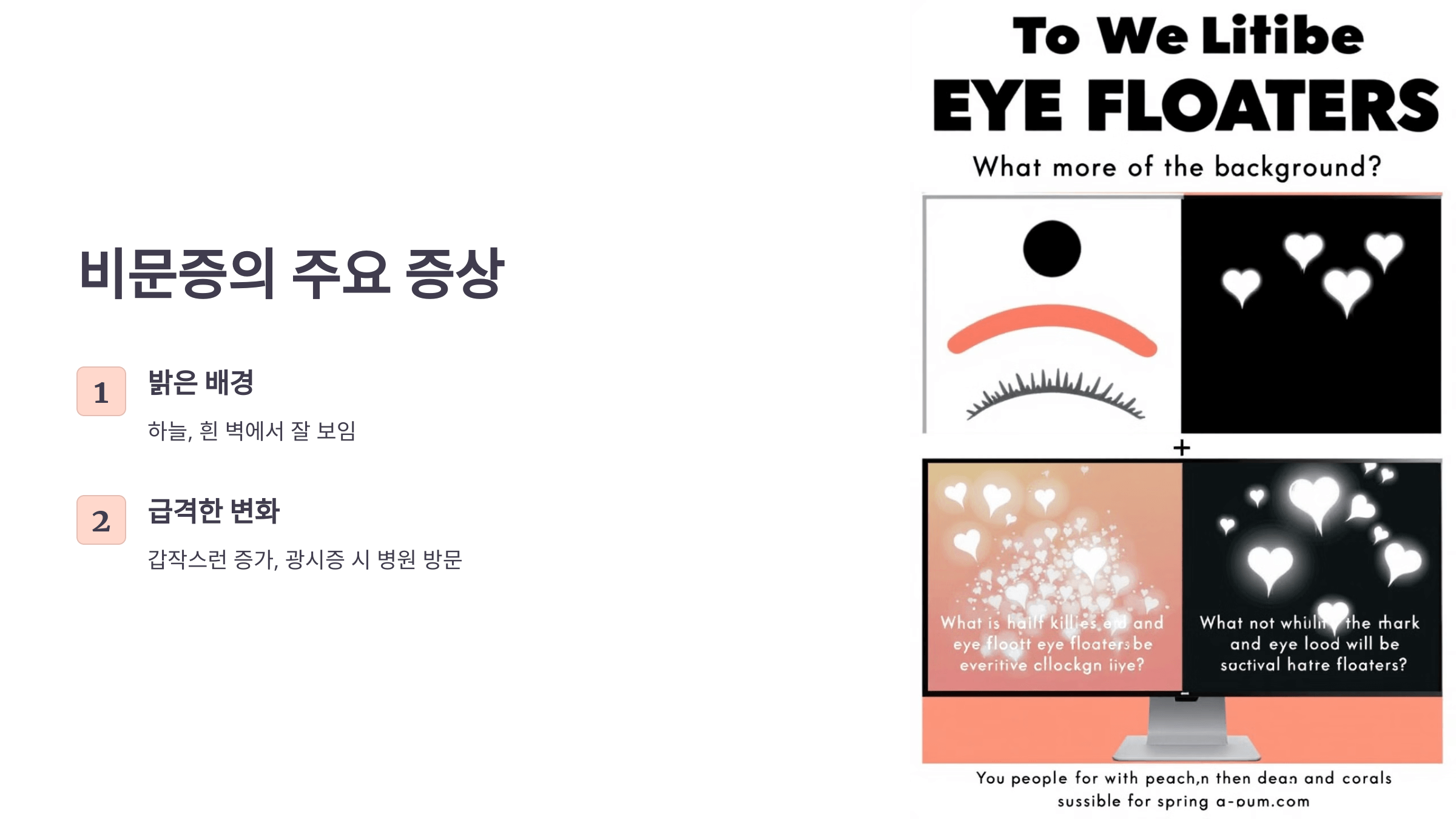 비문증과 관련된 사진입니다.