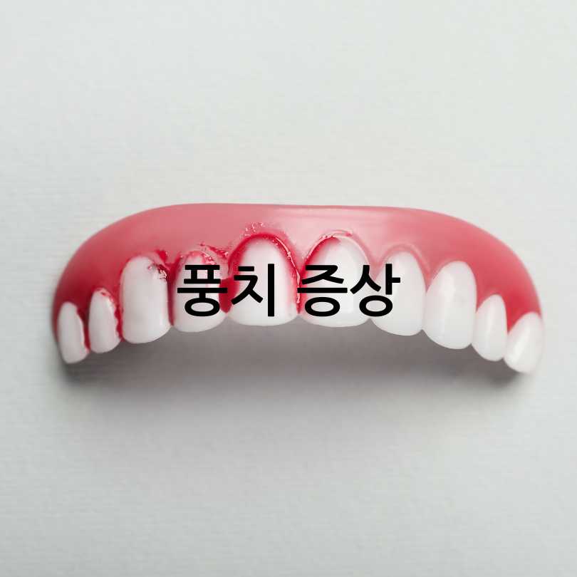 풍치 원인, 증상, 치료법부터 발치