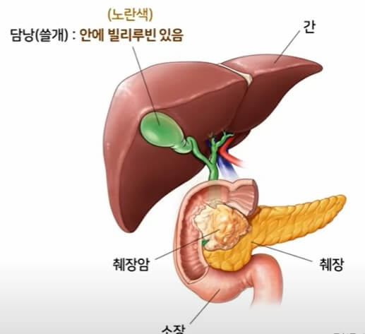 췌장의 위치와 모양