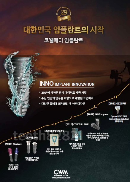 코웰메디-임플란트-종류