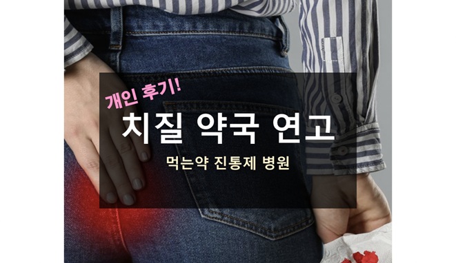 치질 약국 연고