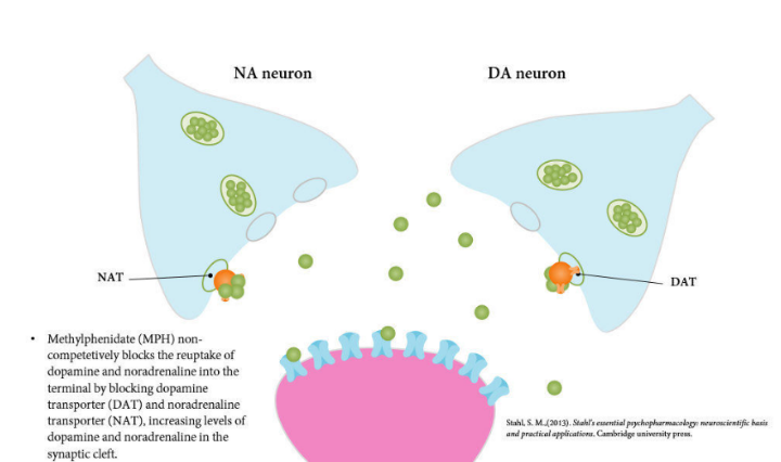 성인 ADHD 콘서타 약 먹고 부작용으로 속 울렁거려서 힘들었네요