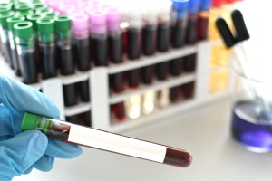 엠폭스 증상 원인 감염경로