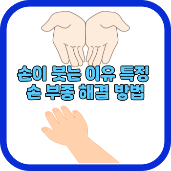 손이 붓는 이유 특징 손 부종 해결 방법