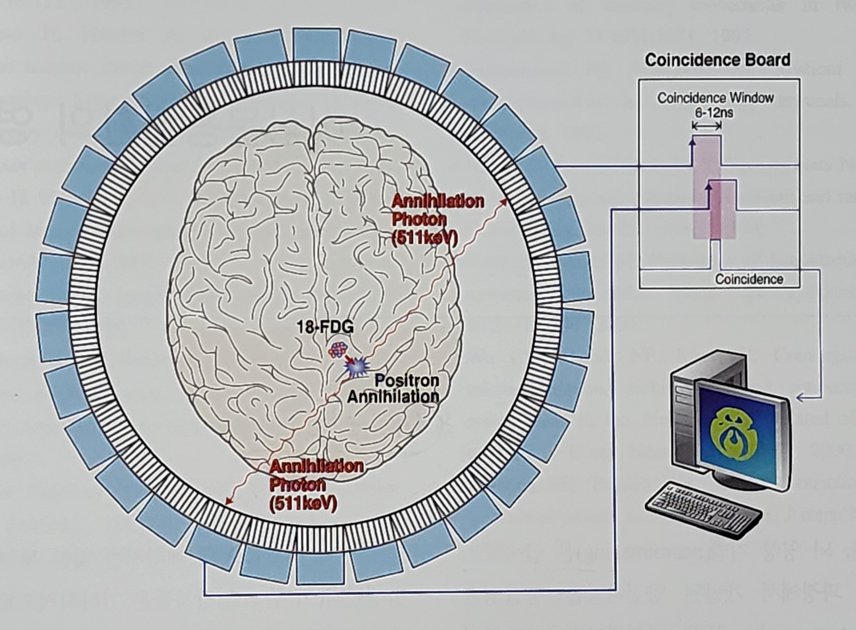 이상운동 질환의 영상기법