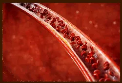 콜레스테롤 개선 후