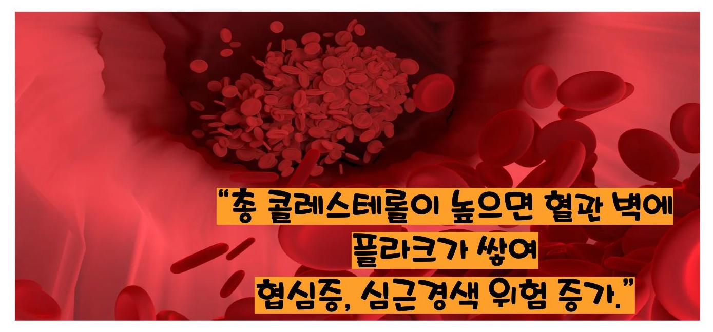 총 콜레스테롤 이란