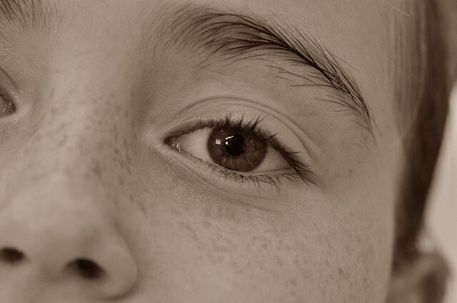 기미 주근깨 차이