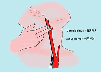 경동맥 위치