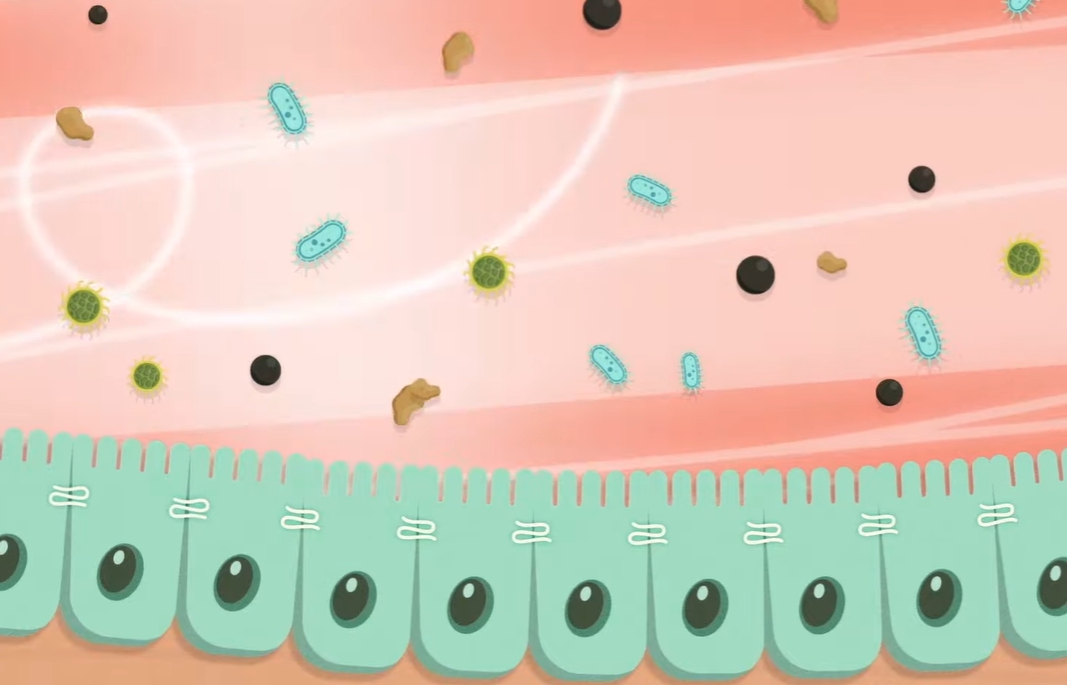 장누수증후군 증상