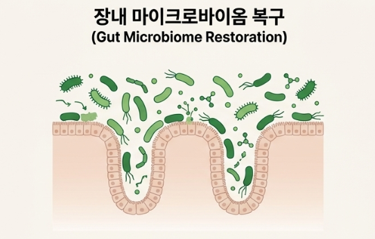 장내 마이크로바이옴(Microbiome) 복구 이미지