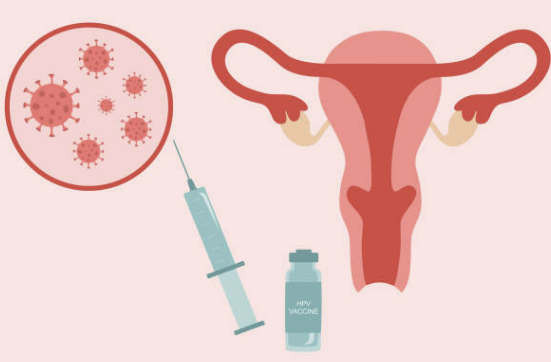 자궁근종 증상과 원인, 싸게 수술하는 방법