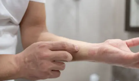 몸이 가려운 이유 4