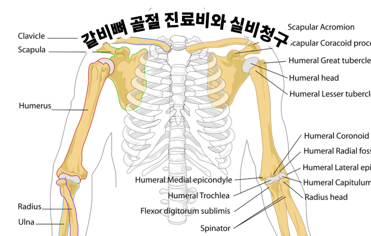 갈비뼈 골절 진료비와 실비청구 총정리
