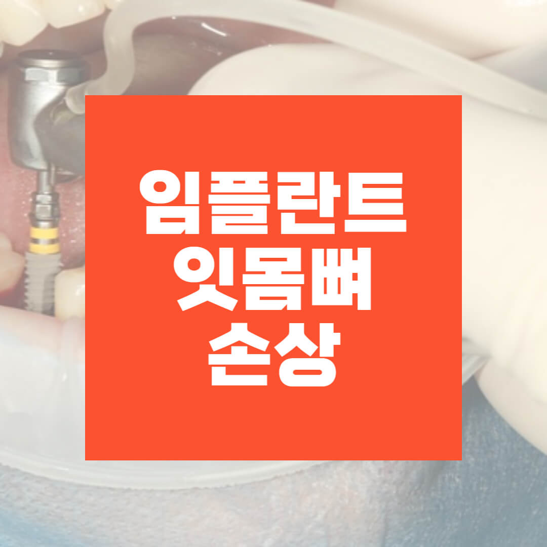 임플란트
임플란트잇몸뼈
임플란트잇몸뼈손상