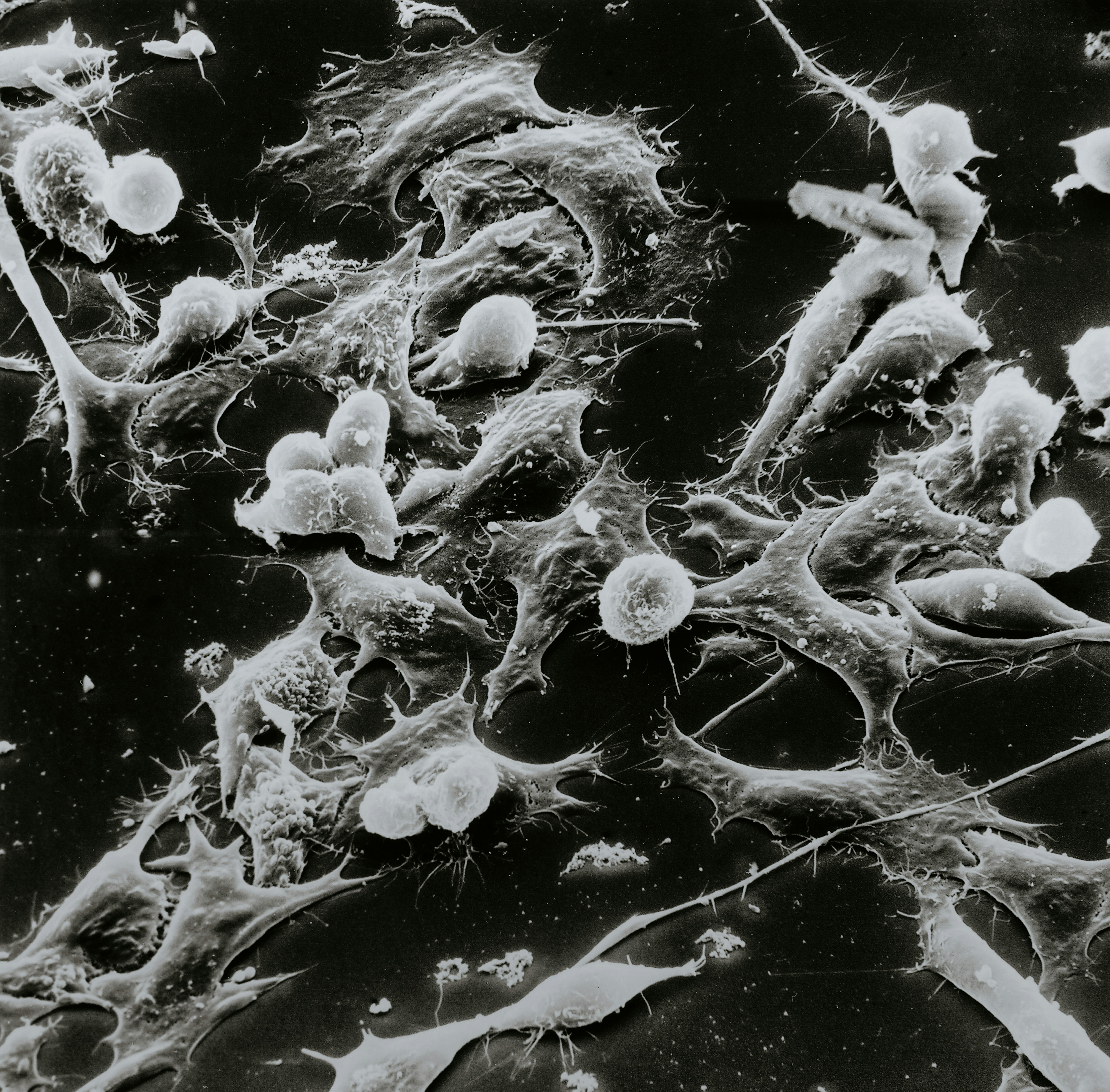 암환자-의료비-지원대상자-선정기준-신청방법