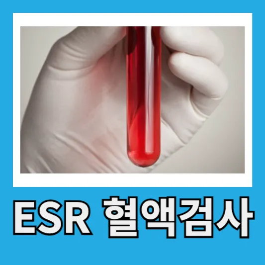 ESR 적혈구침강속도 수치 20~50세 ESR 정상수치 염증수치 혈액검사