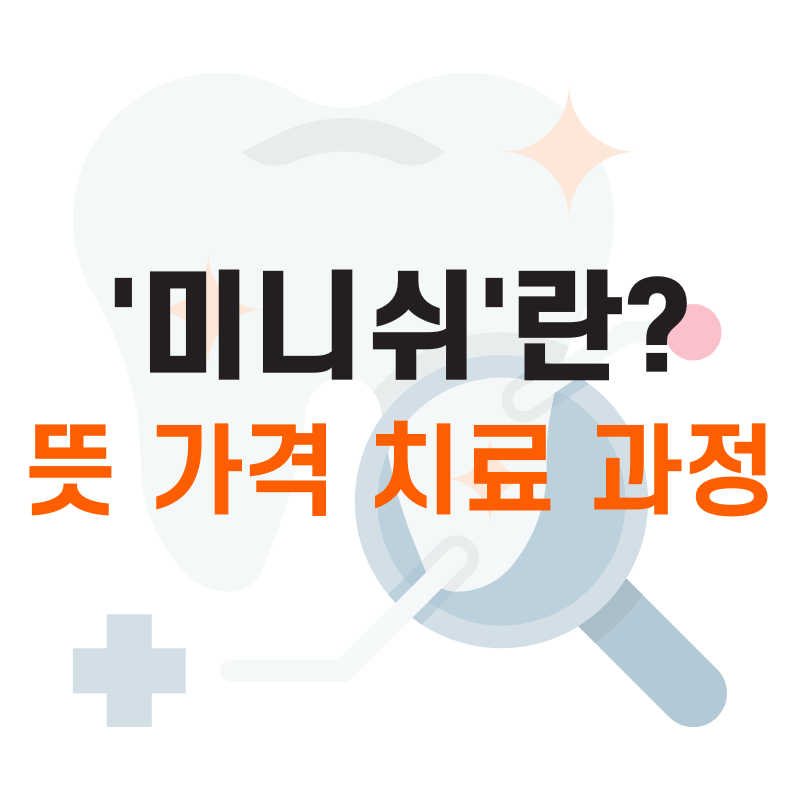 미니쉬 가격