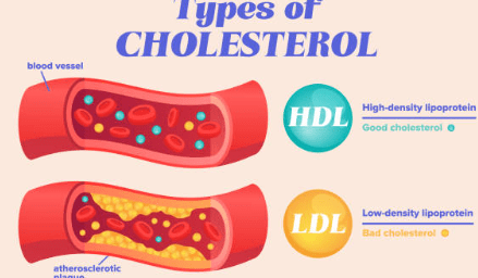 hdl 콜레스테롤 이란? 정상수치 및 높이는 방법