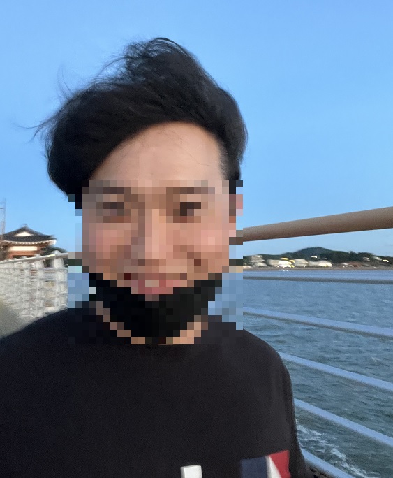 모발이식 바람