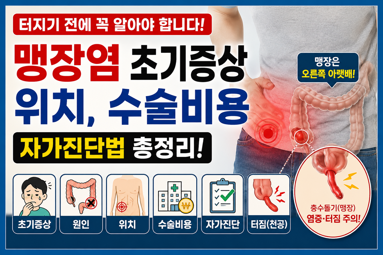 맹장염 총정리