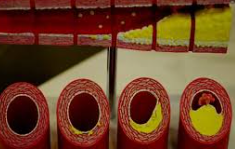 혈관 노화의 주요 원인