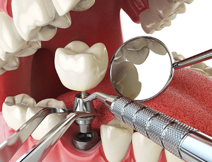 ์ํ๋ํธ ๋ผ์ด์