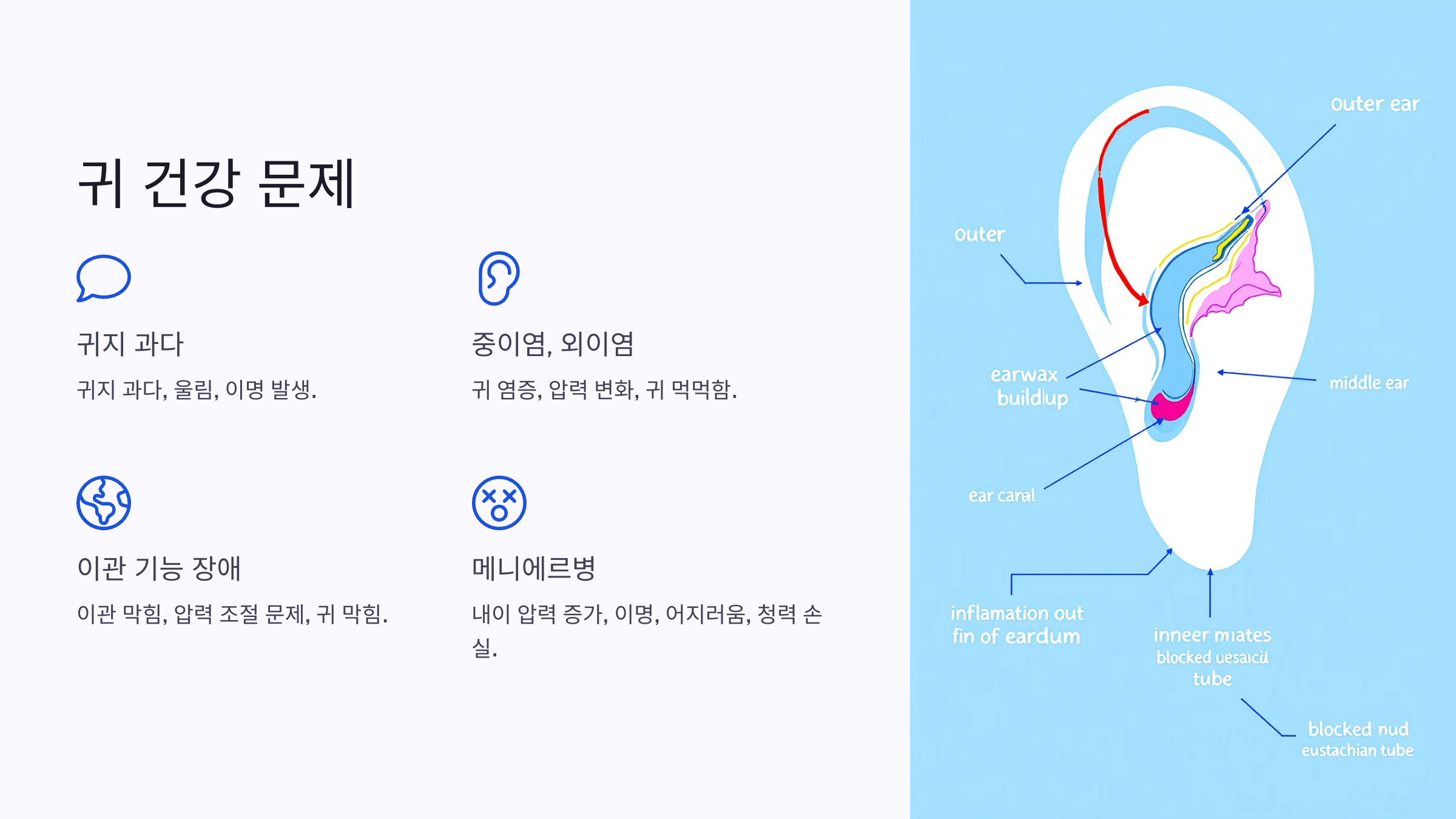 귀 사진입니다.