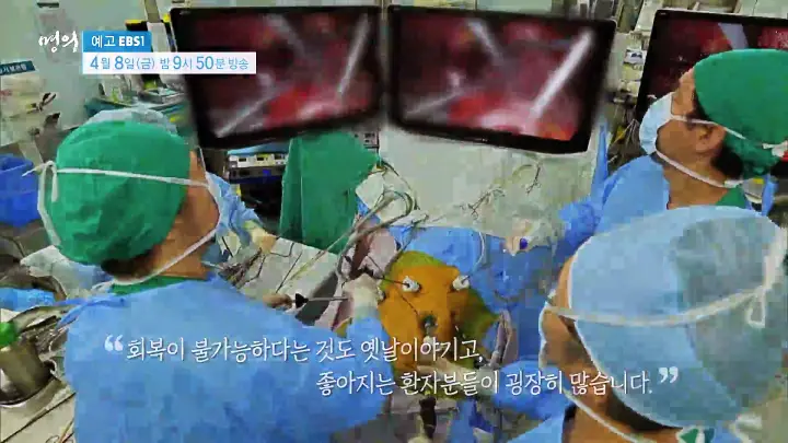 명의 간이식 간암 알프스수술 간경변 간암 간경화 간염 바이러스 전문의 서경석 김기훈 임영석 교수 진료 예약 소개