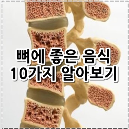 뼈에 좋은 음식 10가지 정리