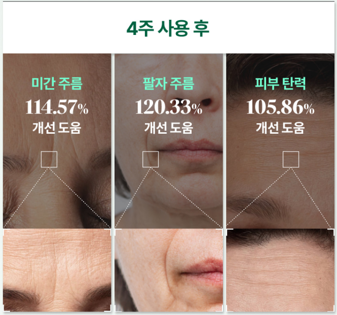 4주-사용-후